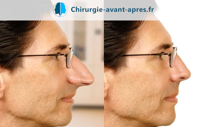 chirurgie