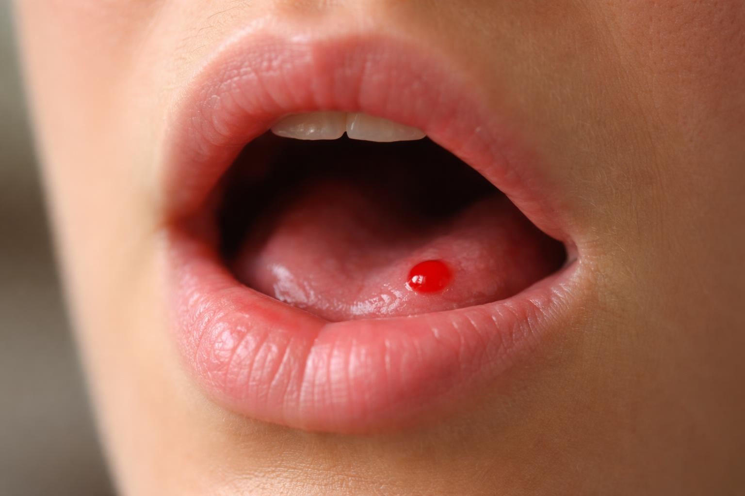 découvrez les causes possibles d'un point de sang dans la bouche et démêlez le mythe de la réalité grâce à notre article informatif et clair.